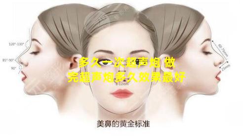 多久一次超声炮 做完超声炮多久效果最好